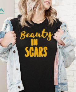 Beauty In Scars Shirt