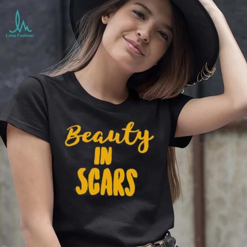 Beauty In Scars Shirt