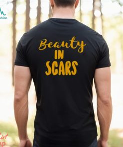 Original beauty In Scars Shirt