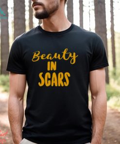 Original beauty In Scars Shirt