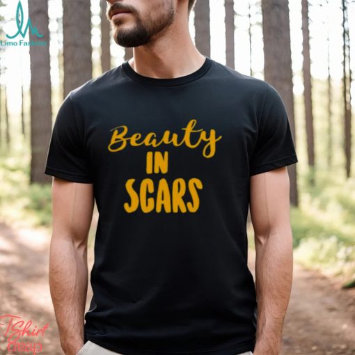 Original beauty In Scars Shirt