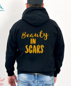 Original beauty In Scars Shirt