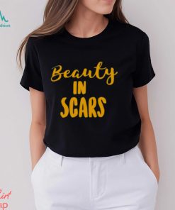 Original beauty In Scars Shirt