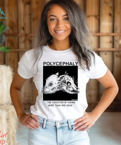 Polycephaly the condition of having more than one head shirt