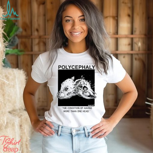 Polycephaly the condition of having more than one head shirt