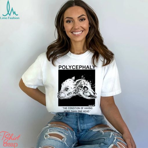 Polycephaly the condition of having more than one head shirt