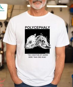 Polycephaly the condition of having more than one head shirt