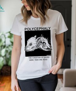 Polycephaly the condition of having more than one head shirt