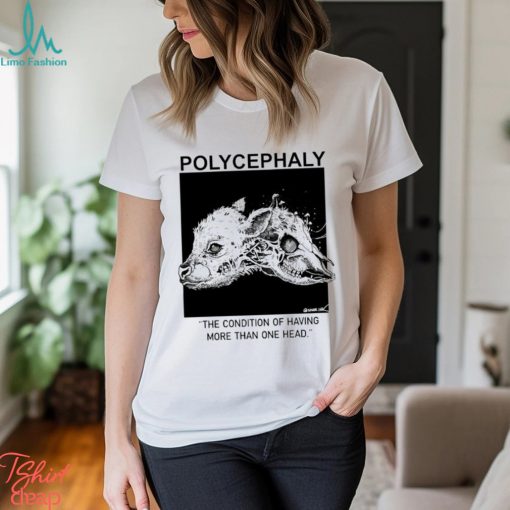 Polycephaly the condition of having more than one head shirt